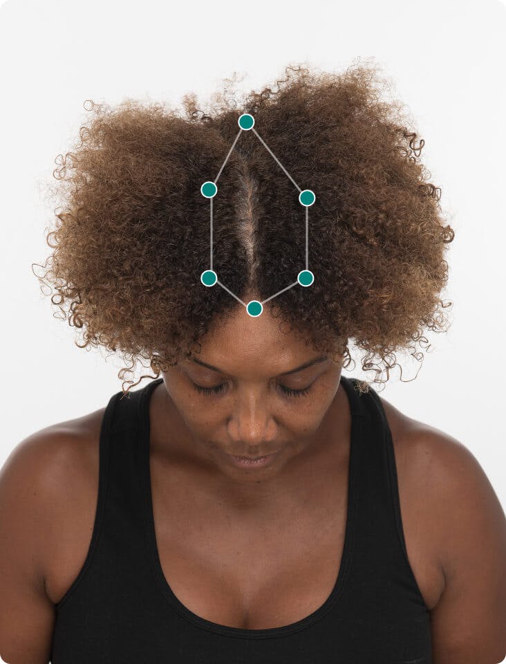 Kimberly before taking Women’s Balance Hair Growth Nutraceutical.