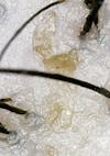 Extreme close-up of a flaky, oily scalp with excess product build-up.