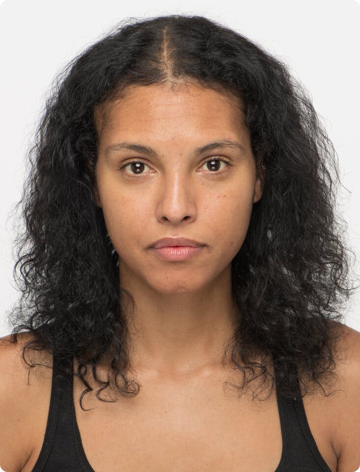 Felisha 6 months into taking Women's Vegan Hair Growth Nutraceutical. Results may vary.