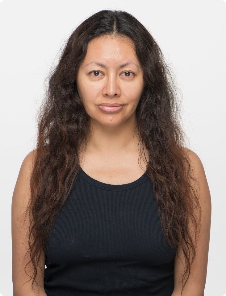 Kayla before taking Women's Vegan Hair Growth Nutraceutical.