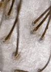 Extreme close-up of hair and scalp prior to using Nutrafol Root Purifier.