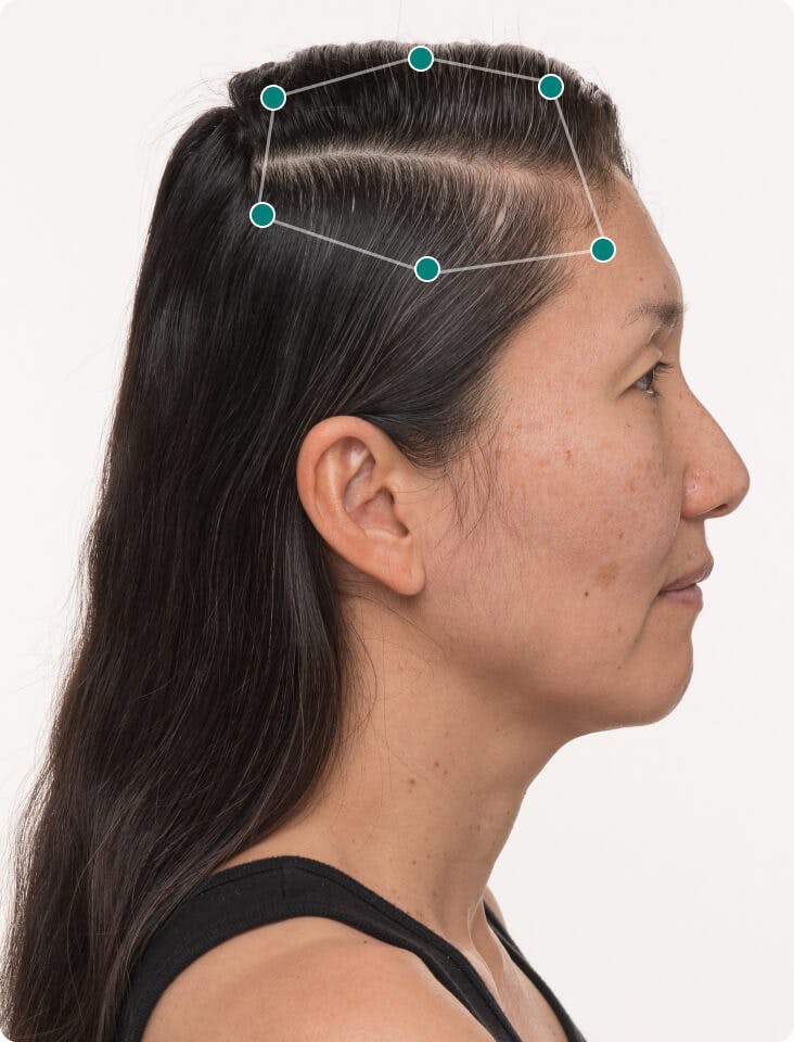 Karin 6 months into taking Women’s Balance Hair Growth Nutraceutical. Results may vary.