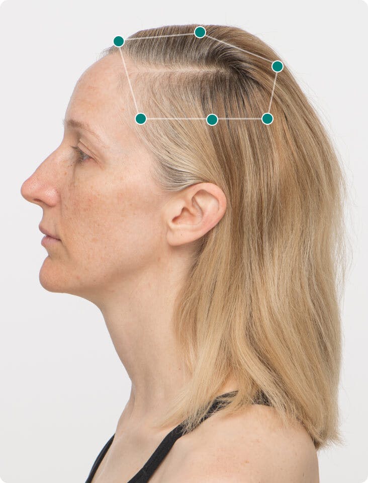 Tanya 3 months into taking Women's Vegan Hair Growth Nutraceutical. Results may vary.