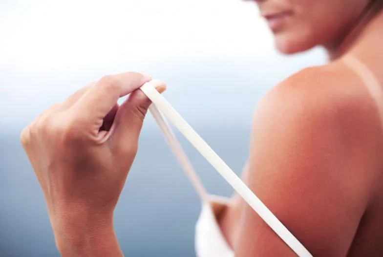 Coup de soleil : quelles solutions naturelles ?