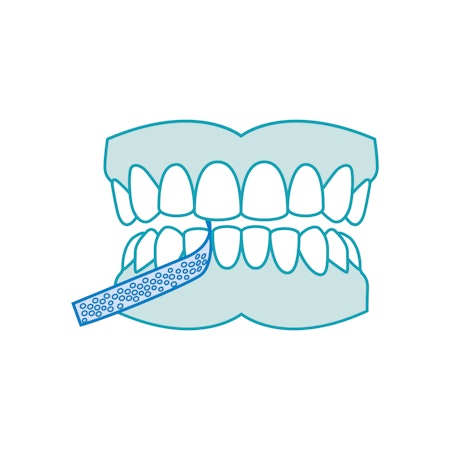 IPR Limage Stripping traitement orthodontique