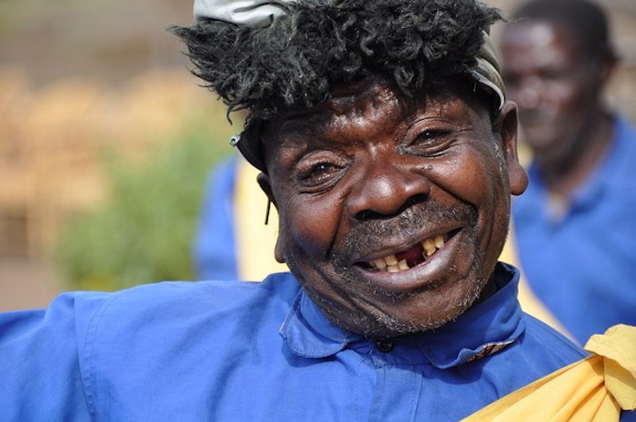 Personne souffrant d'une agénésie dentaire