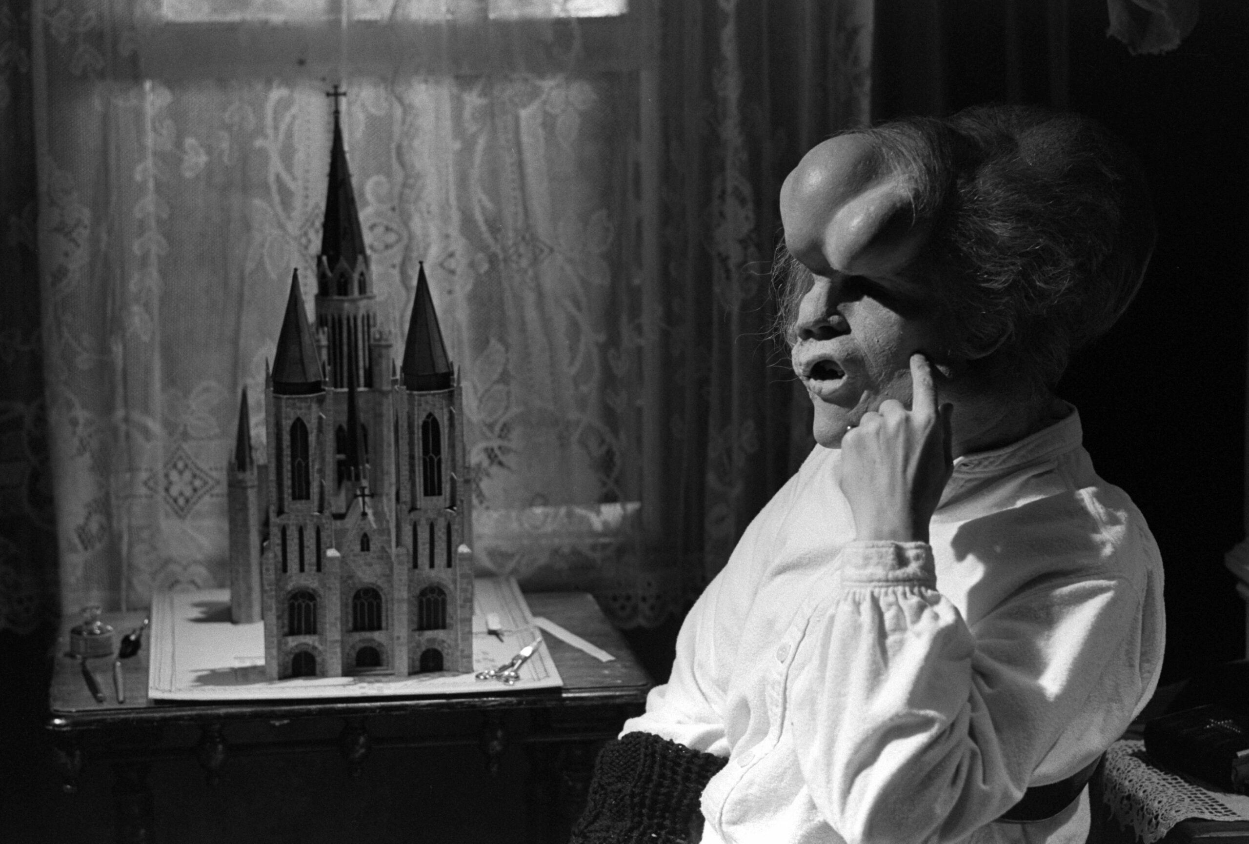 Elephant Man le chef d uvre humaniste de David Lynch