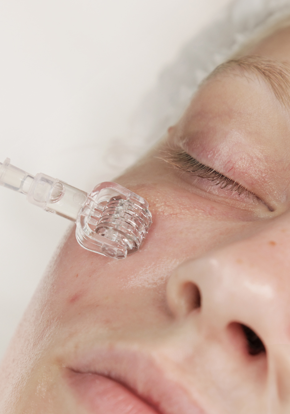 Post-Summer Skincare: Refresh and Rejuvenate – Blog PhiAcademy