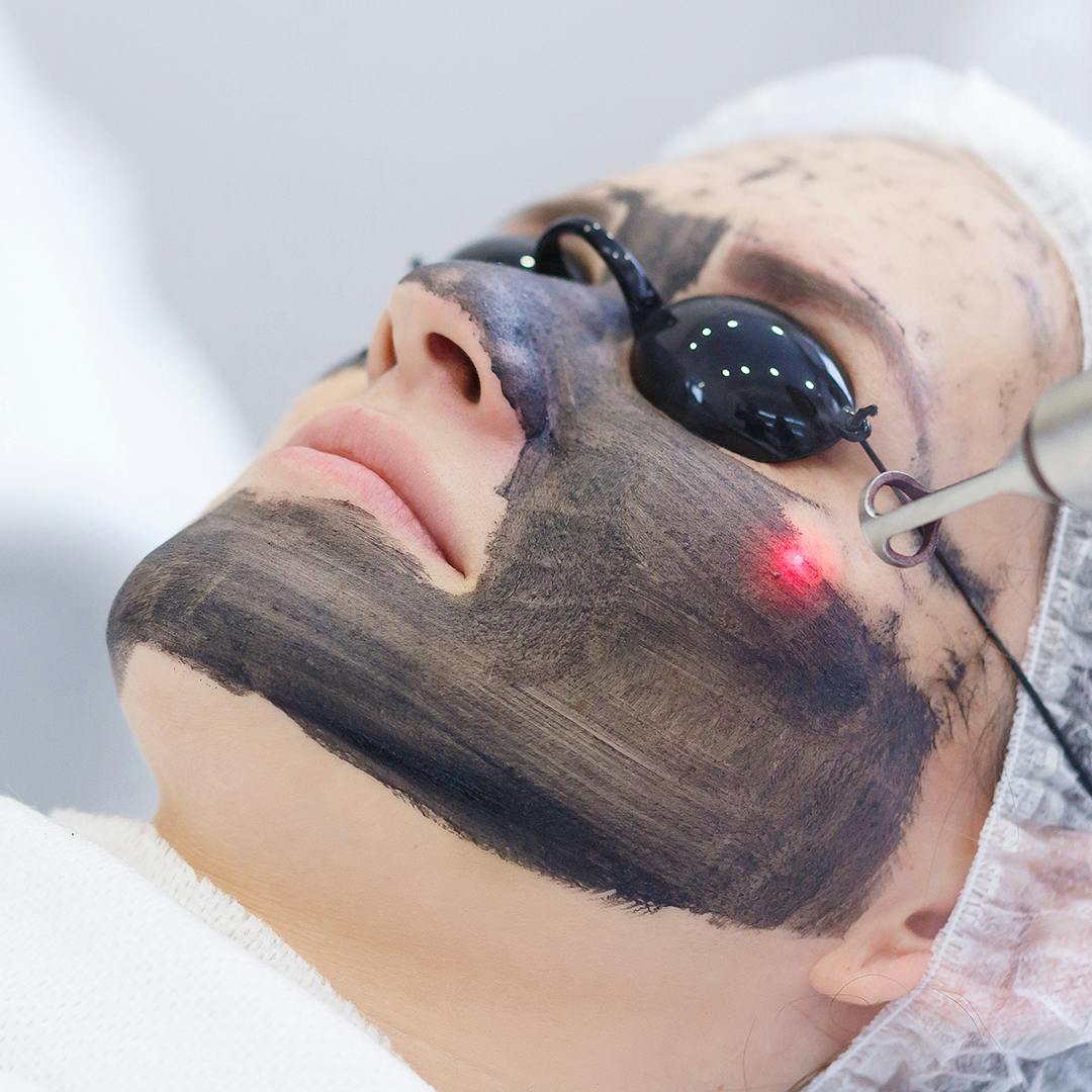 Laser treatments offer a powerful solution for advanced skin correction by penetrating deeper skin layers. They effectively fade dark spots, boost collagen production, and enhance overall skin tone and firmness