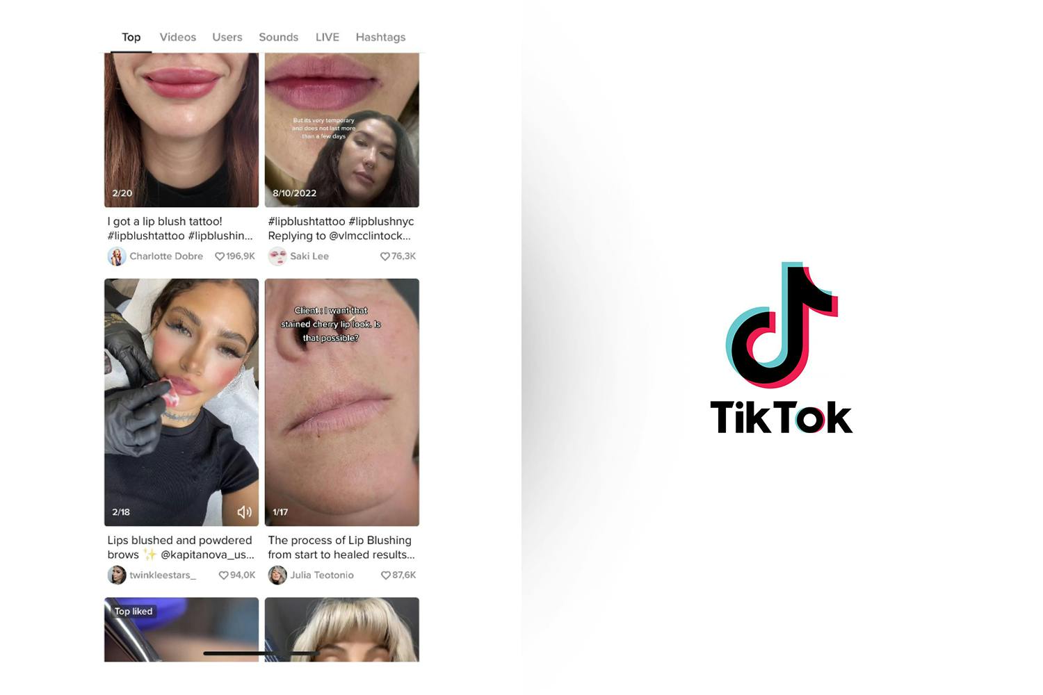 TikTok is flooded with videos from satisfied lip contours!