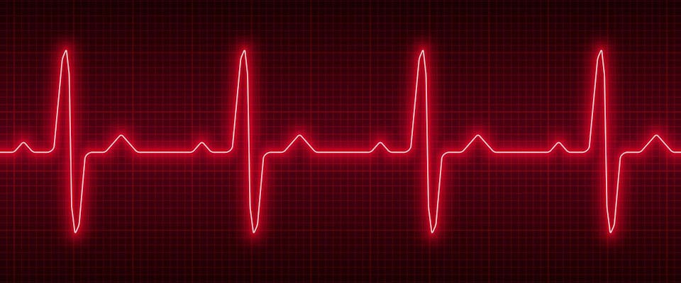 Mutazioni genetiche, la Causa Nascosta dietro l'Arresto Cardiaco