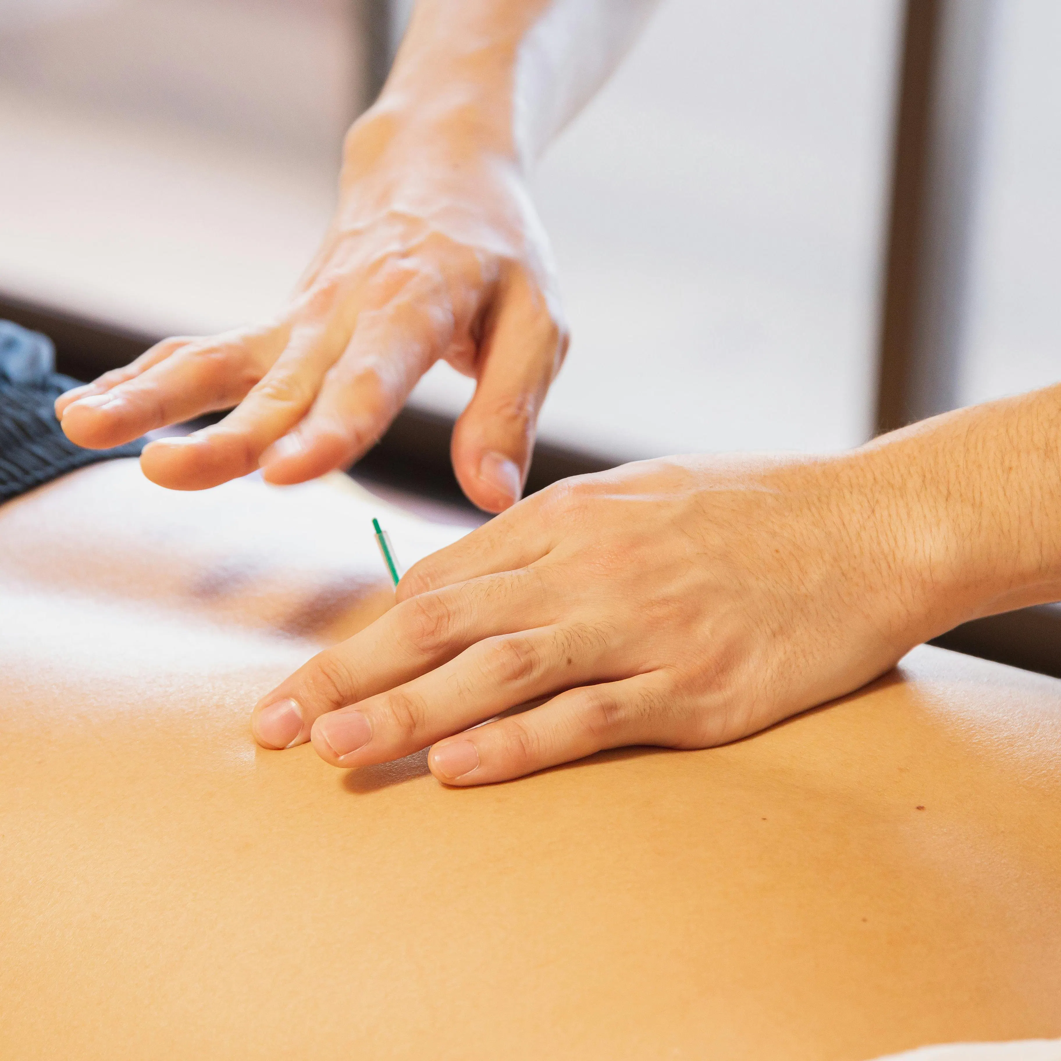 Dry Needling