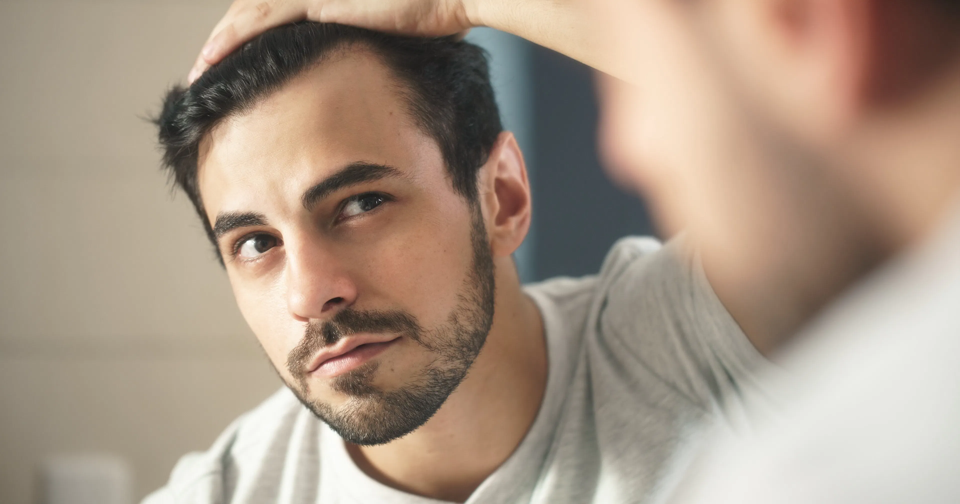 man worried about receding hairline