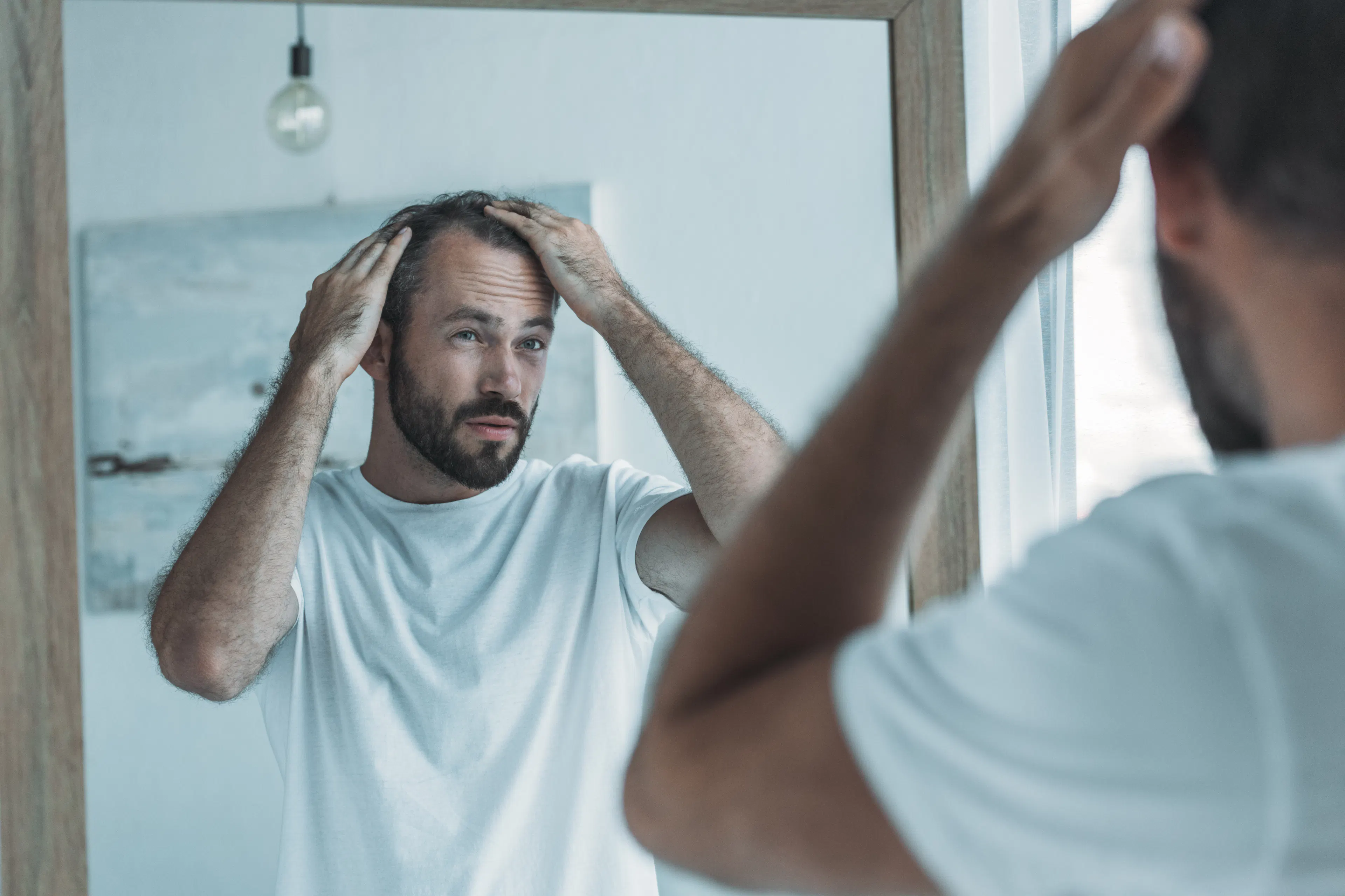 middle-aged man checking for hairloss