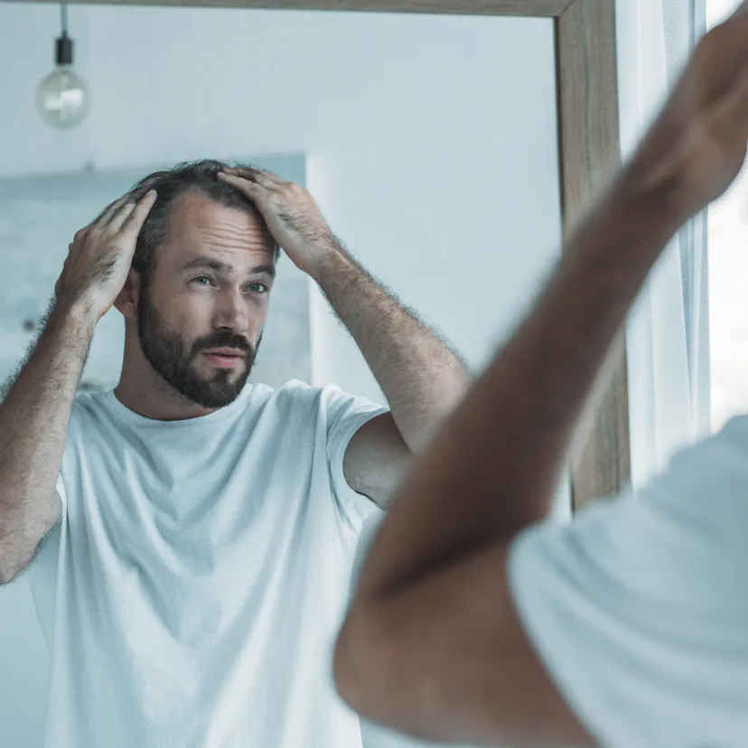 middle-aged man checking for hairloss