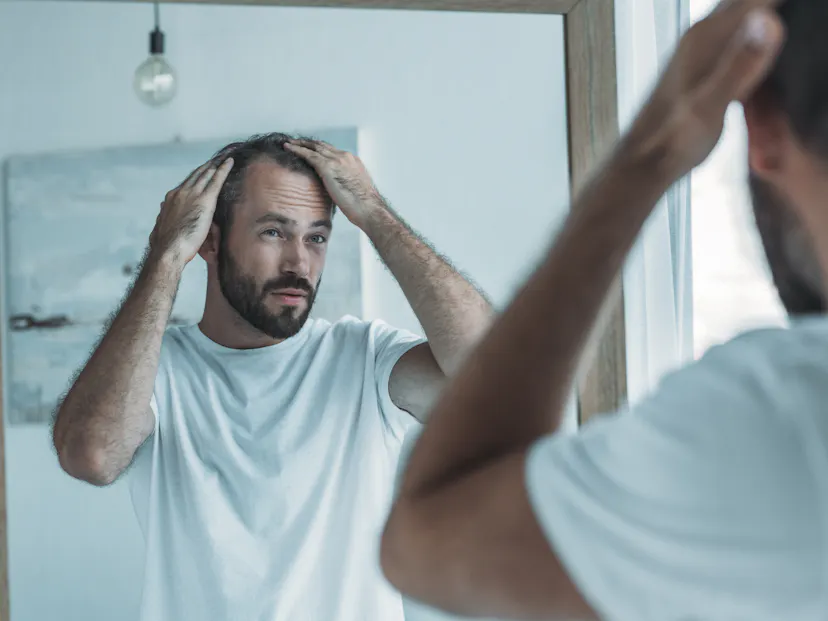 middle-aged man checking for hairloss