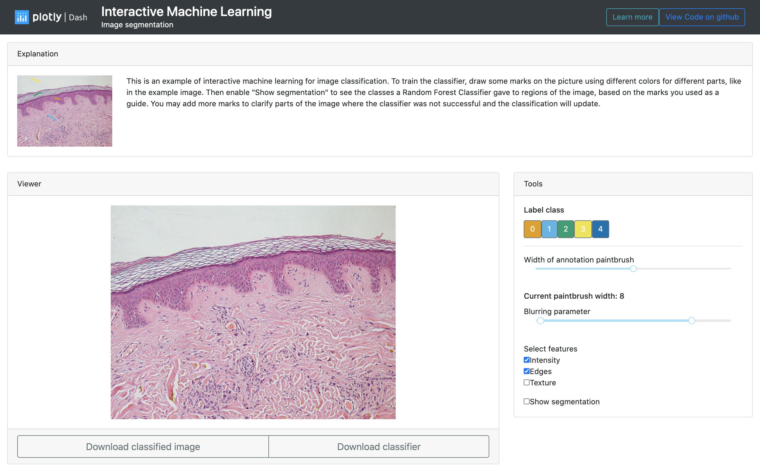 image segmentation
