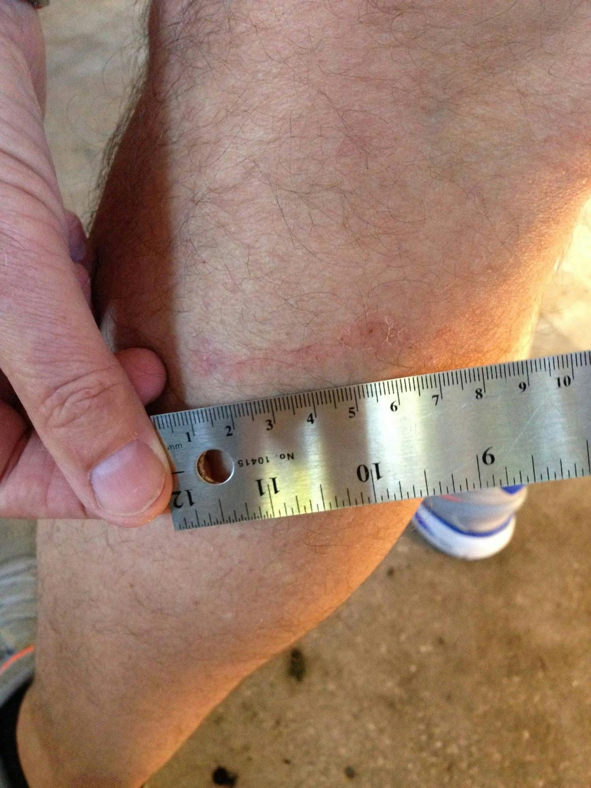 Leg showing abrasion and minor scratching rather than what may have happened with a level 4 bite without Kevlar pants.
