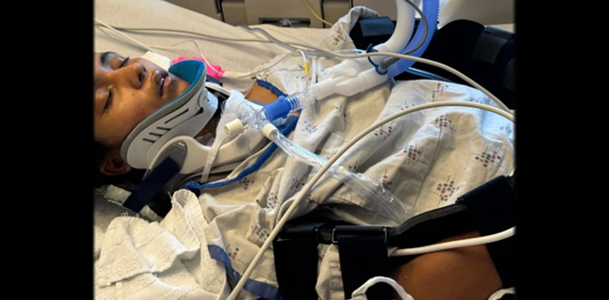 US tragedy: Indian girl fights for life