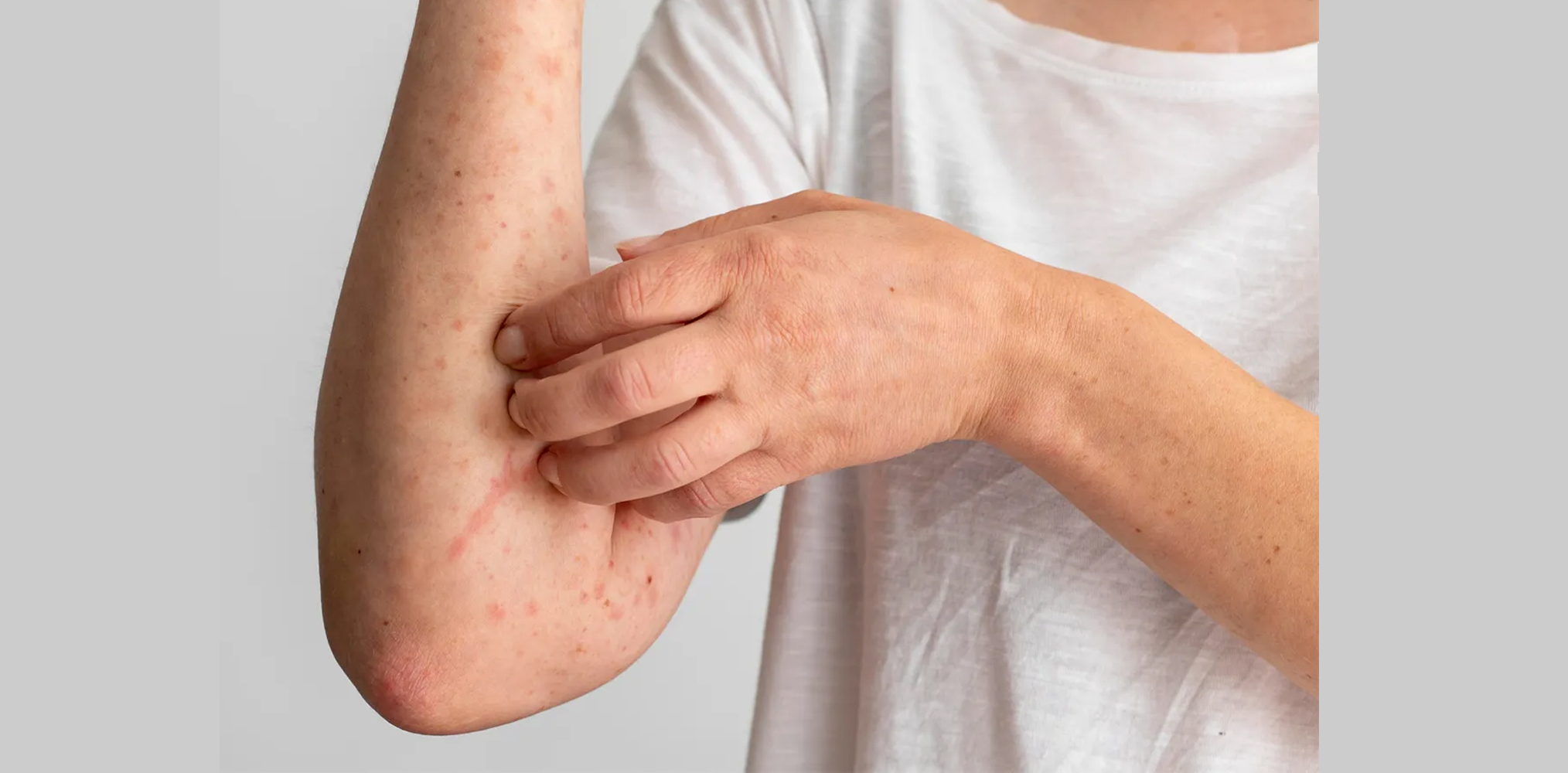 Summer Chill or Skin Kill: The Hidden Perils of AC