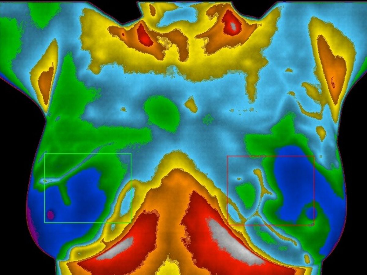 Breast Thermography In Sonoma Country