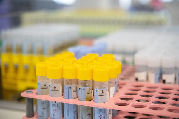 Collection of samples