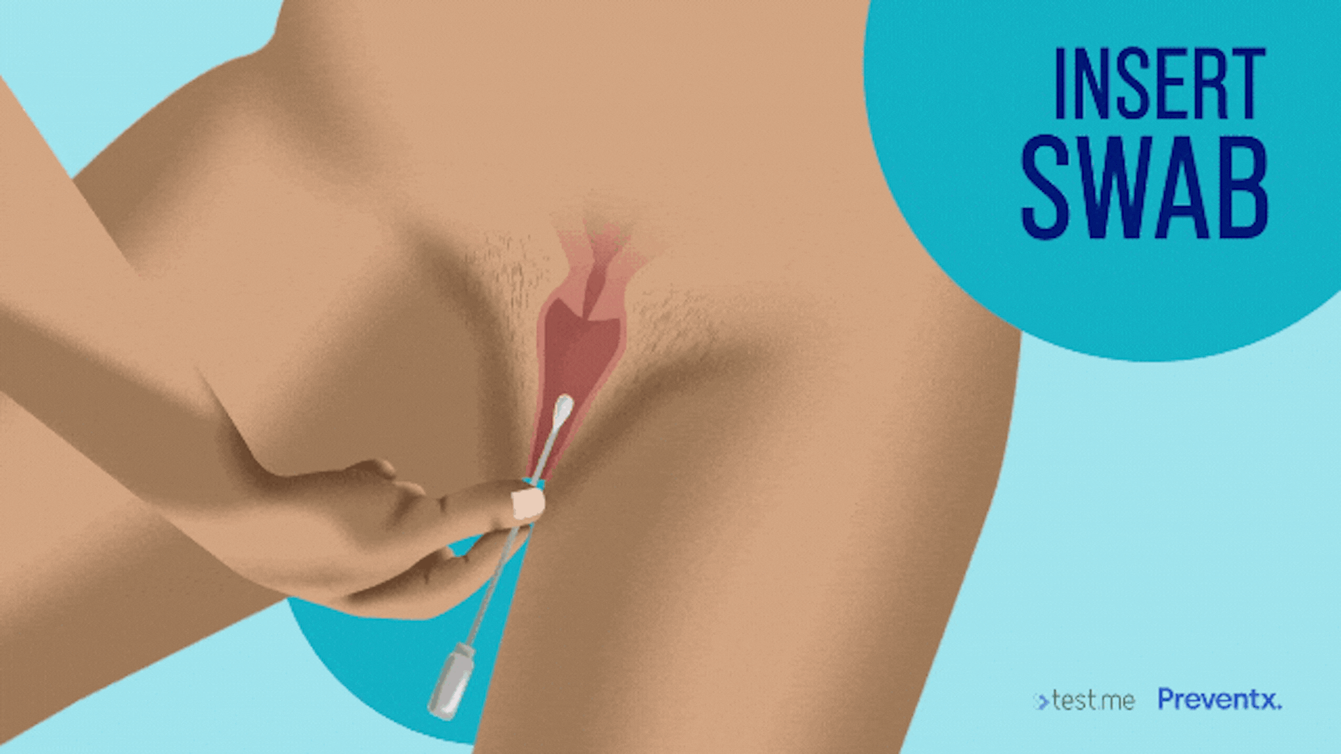 Image showing how to collect a vaginal swab sample