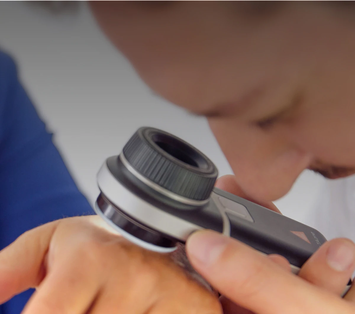 Gros plan d'un médecin examinant attentivement la peau d'une patiente à l'aide d'un dermatoscope.