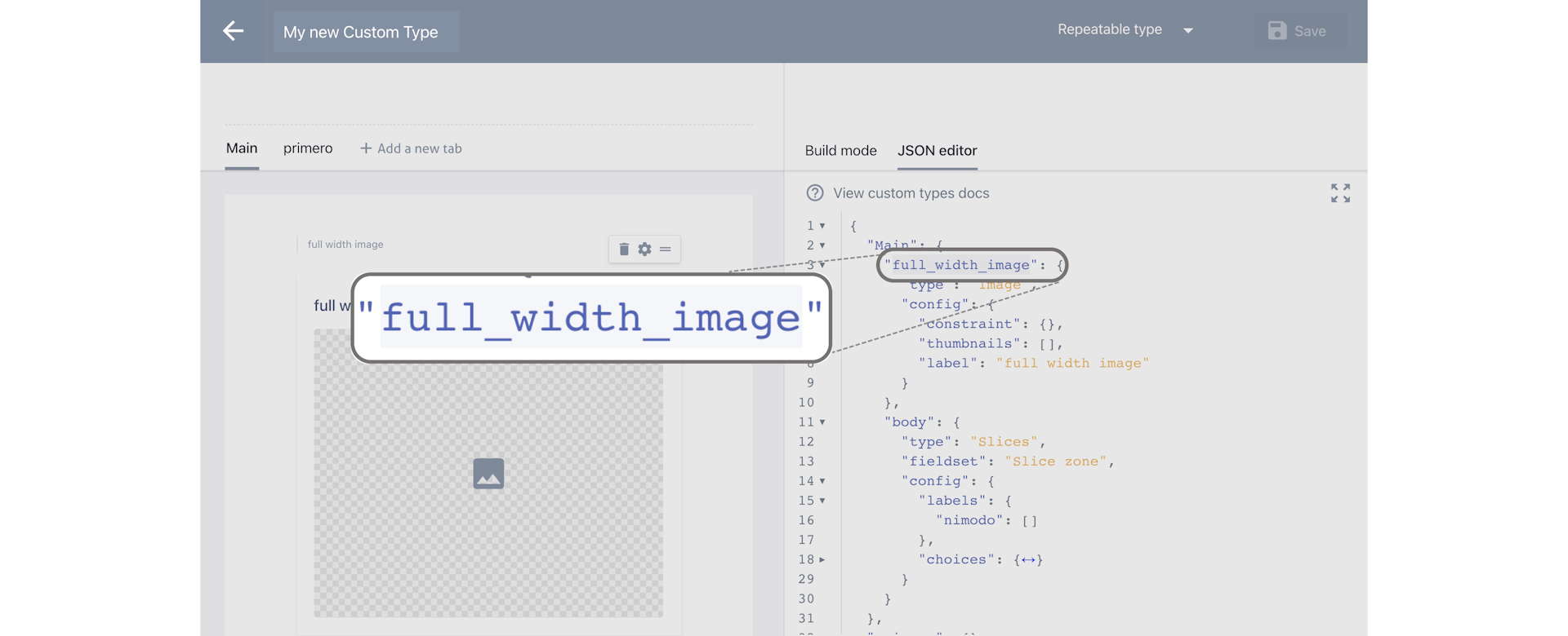 Screenshot of the Prismic custom types JSON Editor.