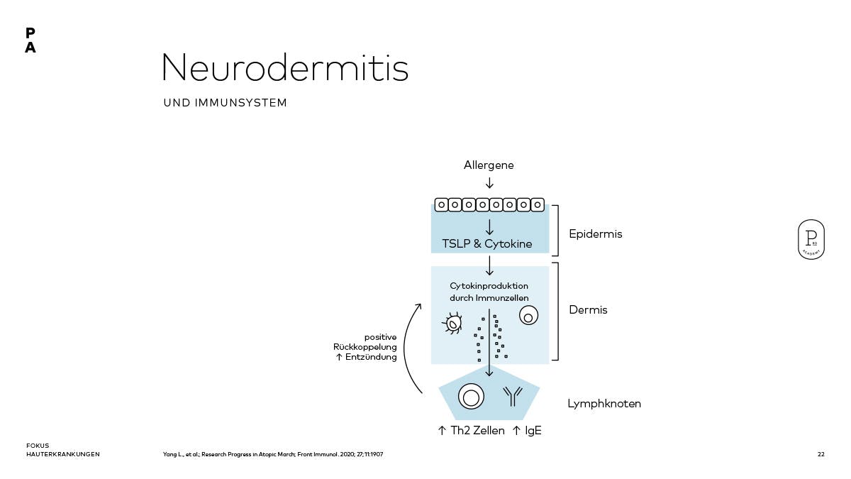 Neurodertmitis & Immunsystem