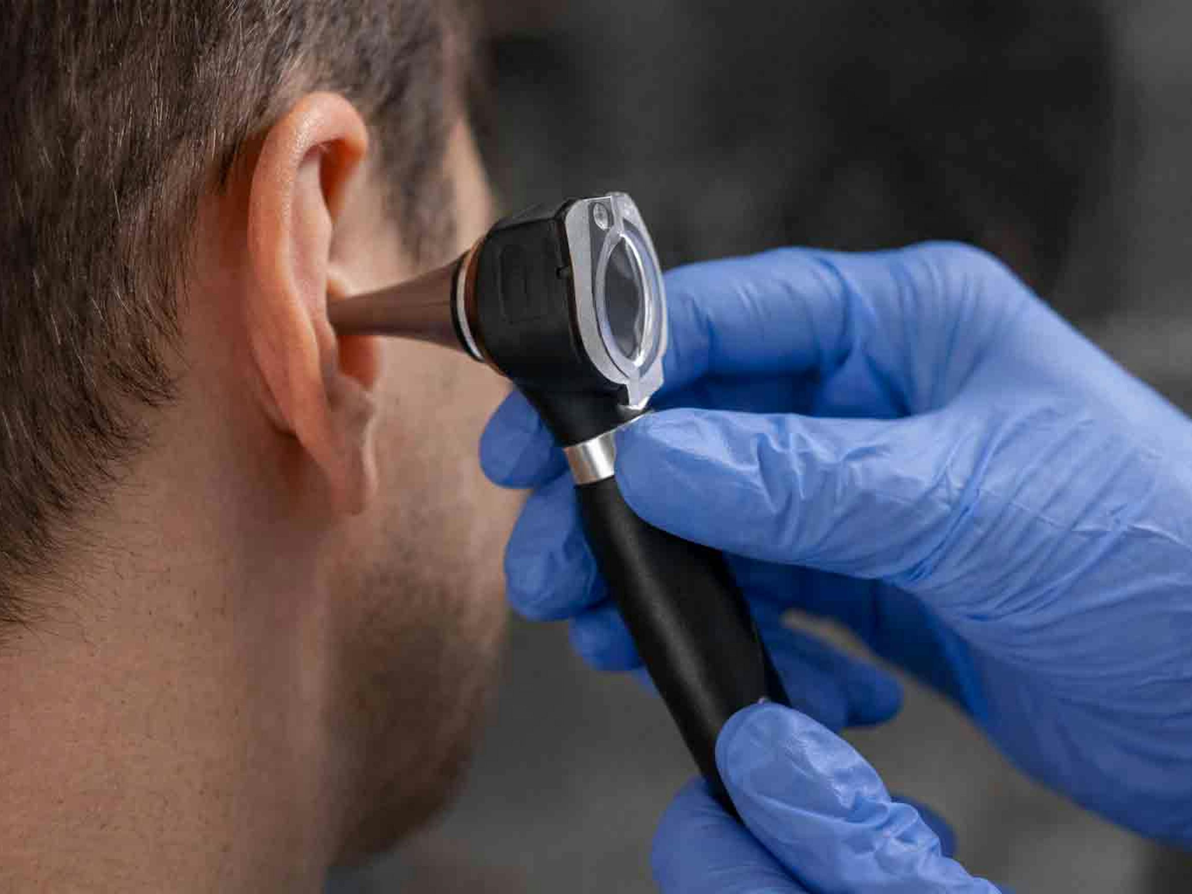 Earwax removal consultation