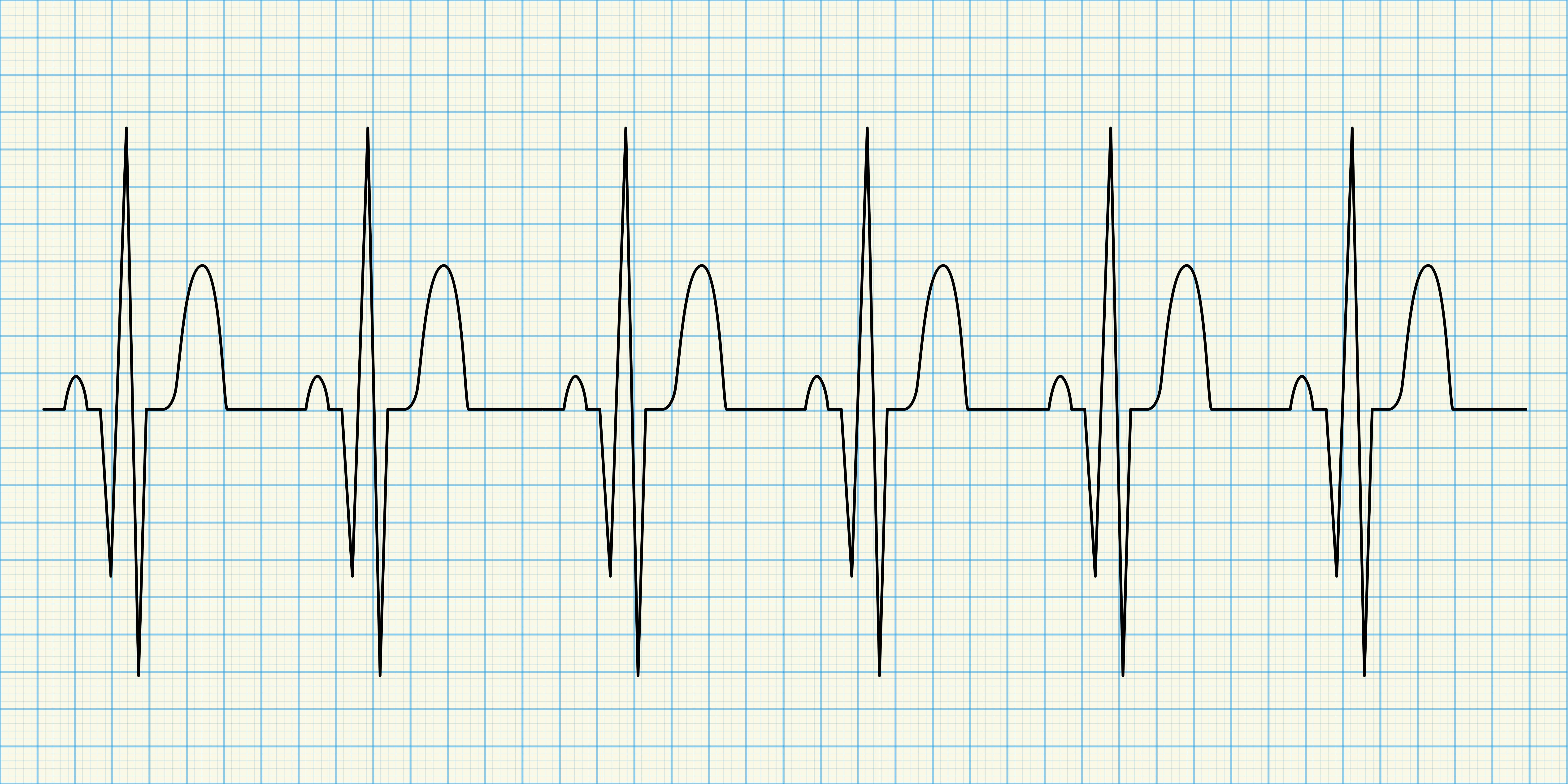 EKG