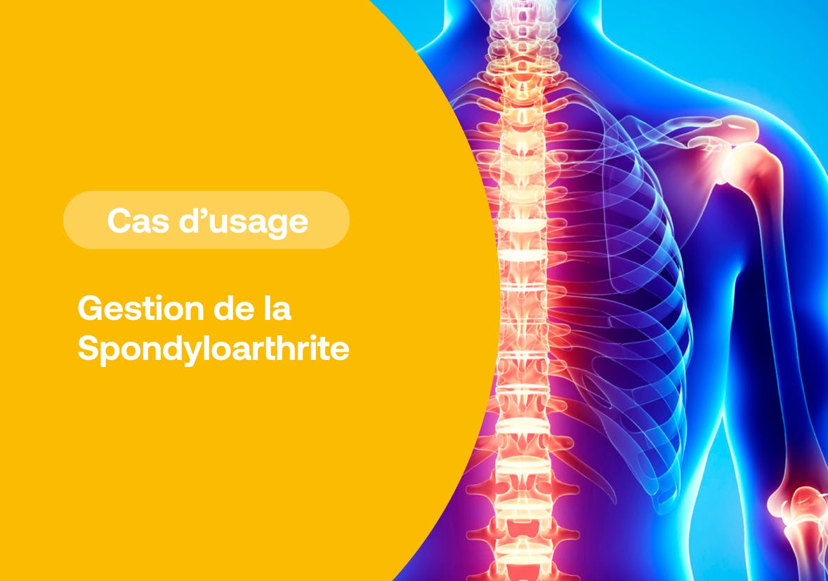 Spondyloarthrite : optimiser sa prise en charge