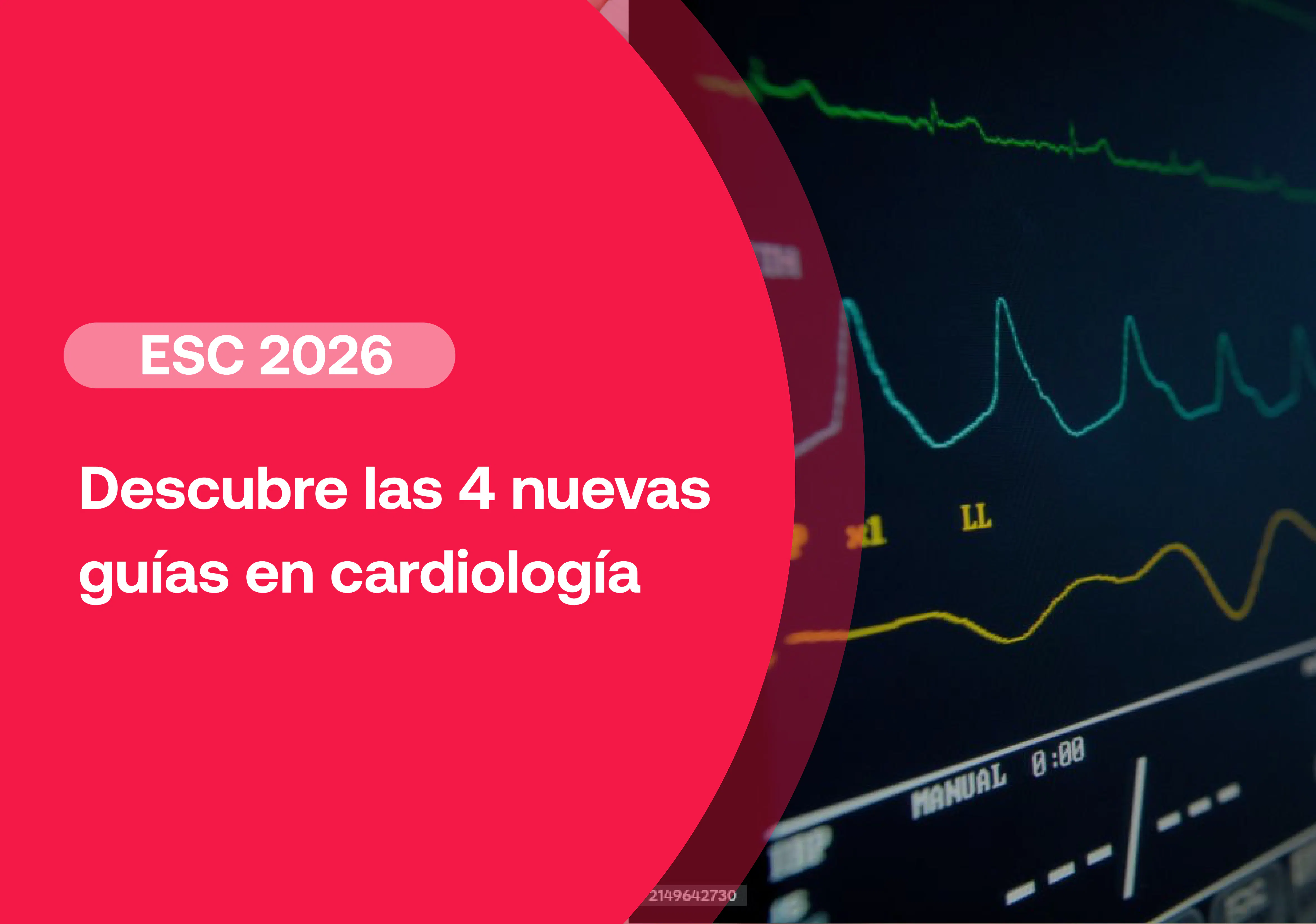 Guías ESC 2026 : estos son los principales cambios