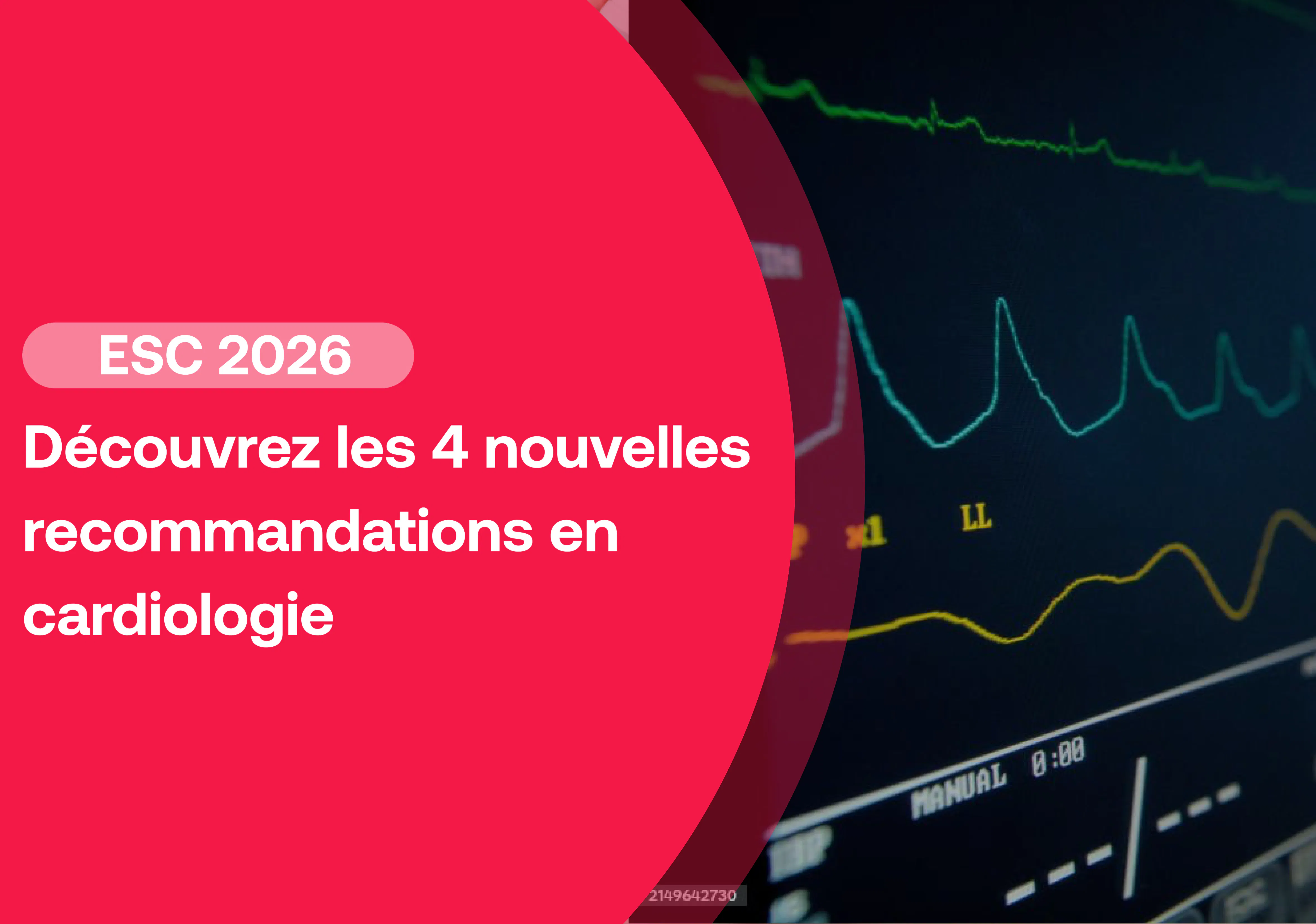 Recommandations ESC 2026 : les changements à connaître