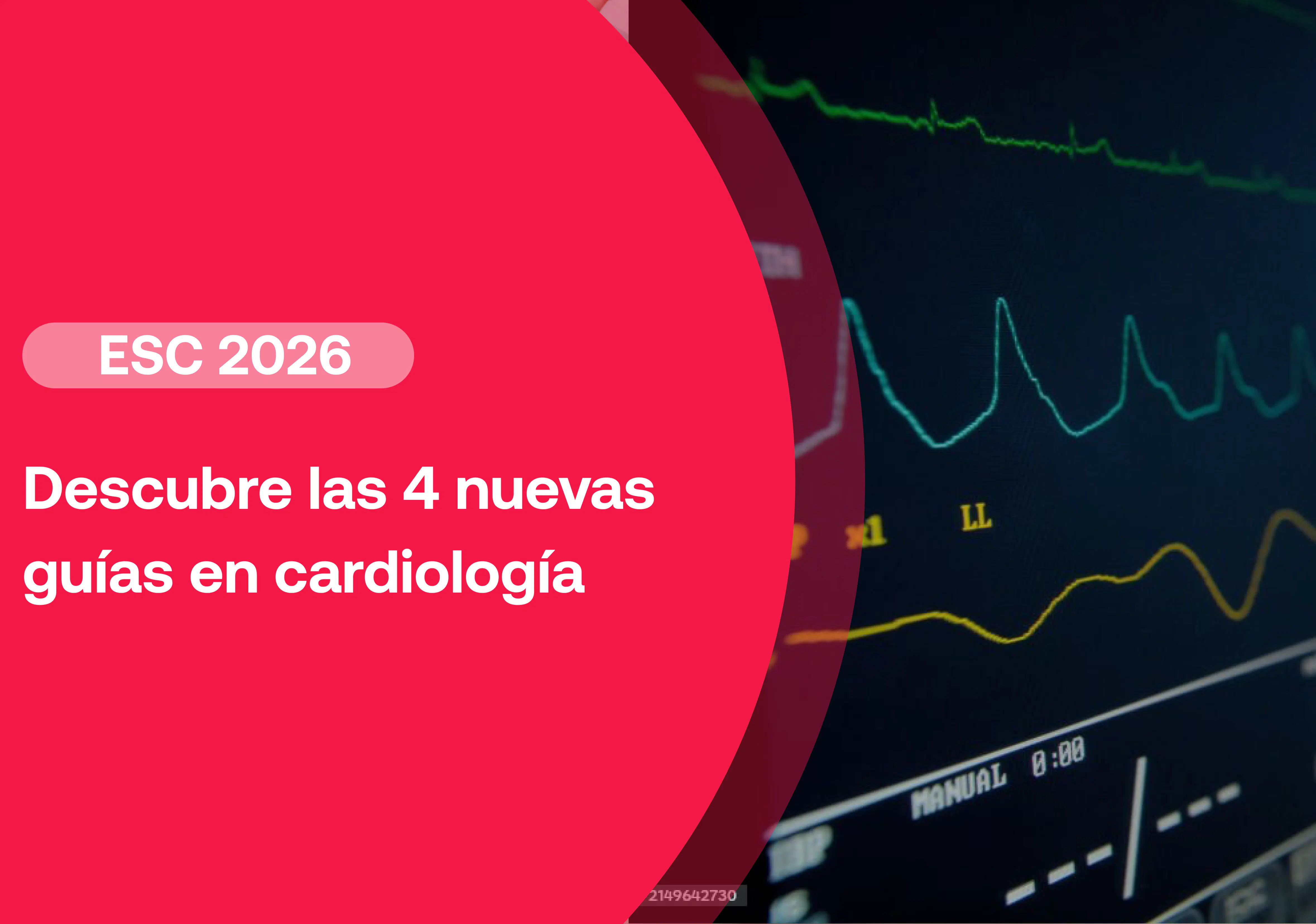 Recomendaciones ESC 2026: estos son los principales cambios