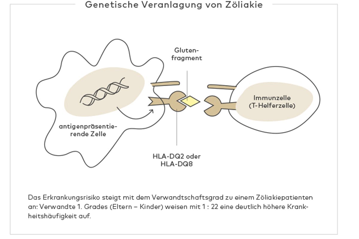 Genetische Veranlagerung von Z&ouml;liakie