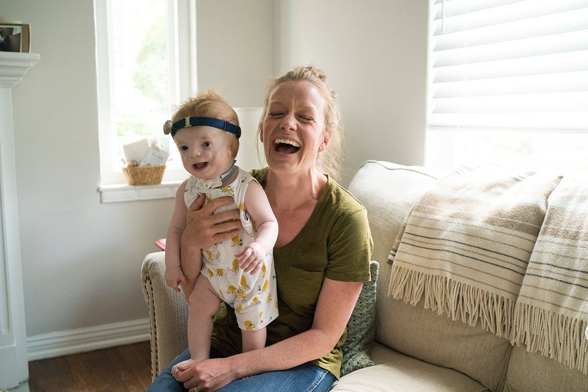 Photograph of young child with Treacher Collins syndrome and mother by documentary photographer Kirsten Lewis