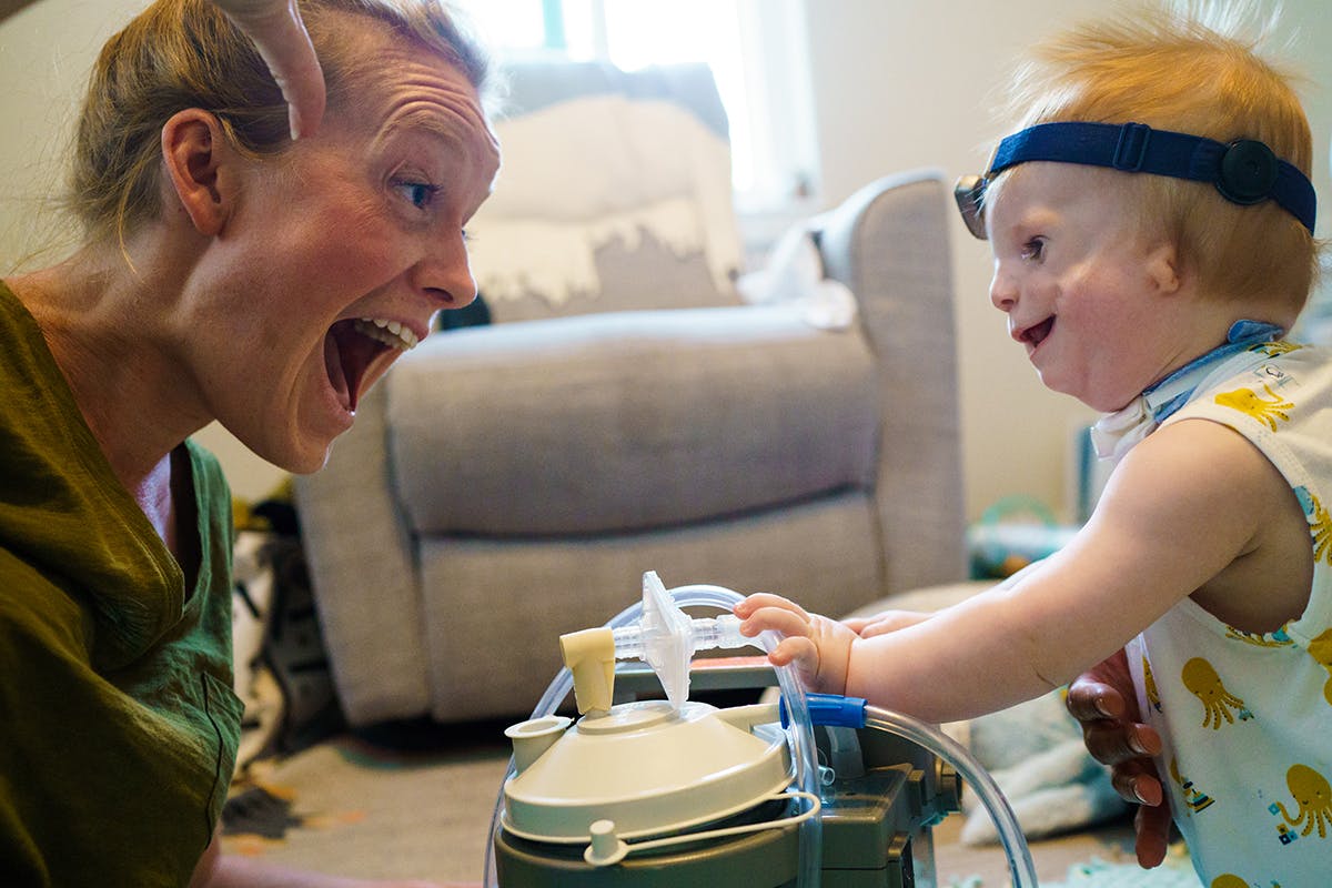 Photograph of young child with Treacher Collins syndrome and mother by documentary photographer Kirsten Lewis