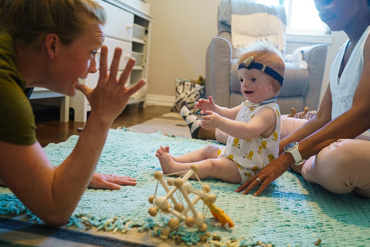 Photograph of young child with Treacher Collins syndrome and family by documentary photographer Kirsten Lewis