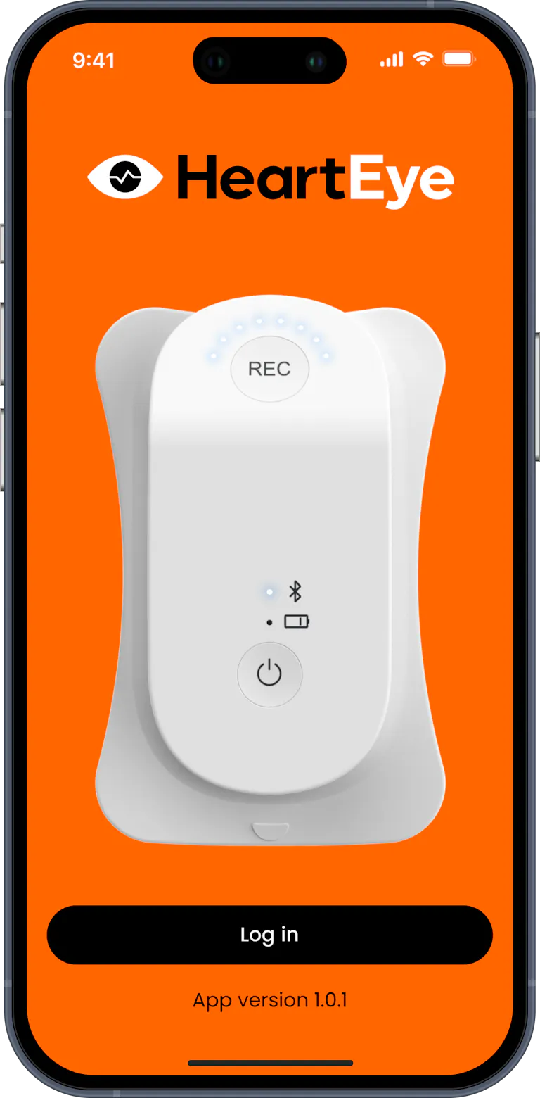 Phone with the HeartEye mobile app showing the ECG device.