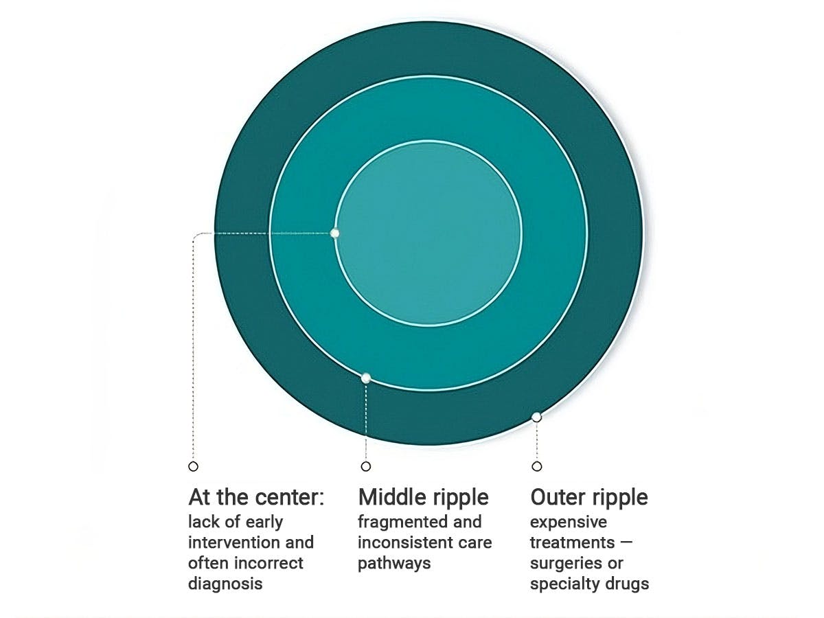 Cost Ripple Effect Chart