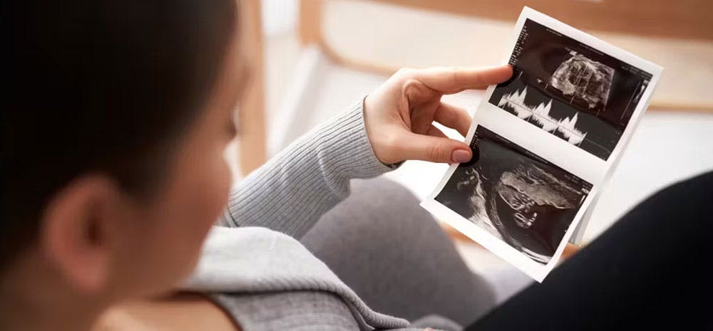 Woman looking at her Ultrasounds