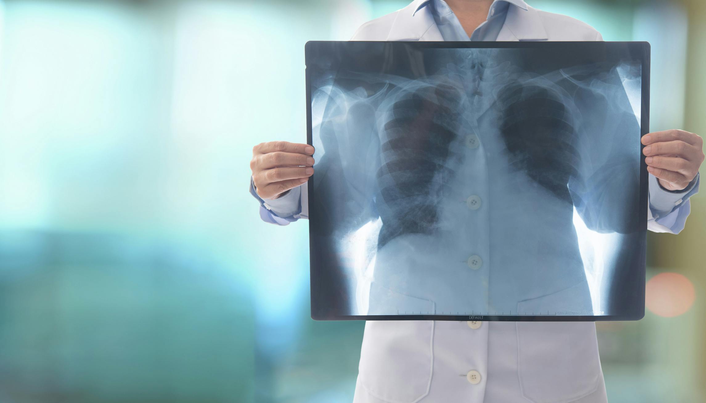 woman holding a radiology image