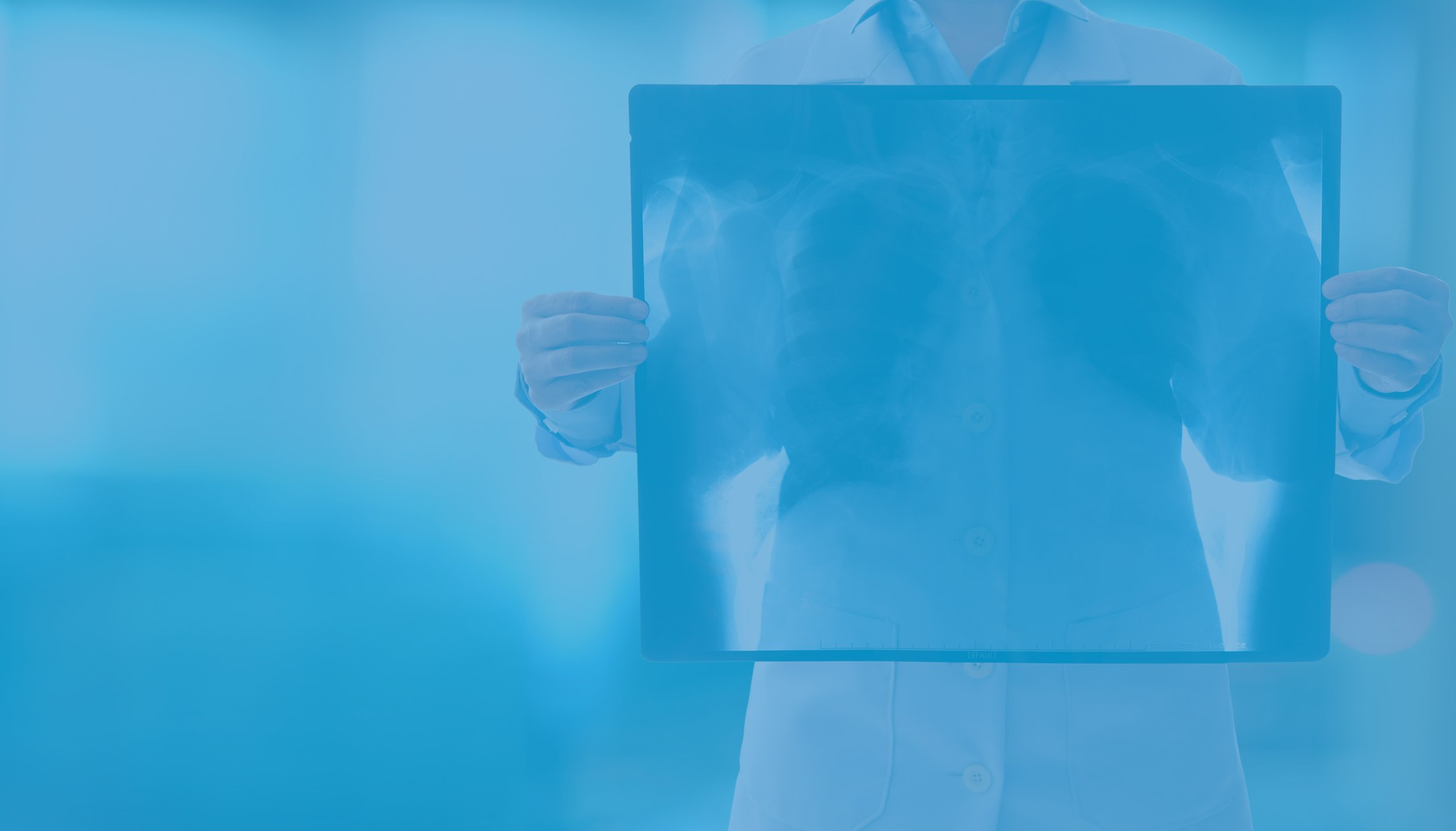 woman holding a radiology image