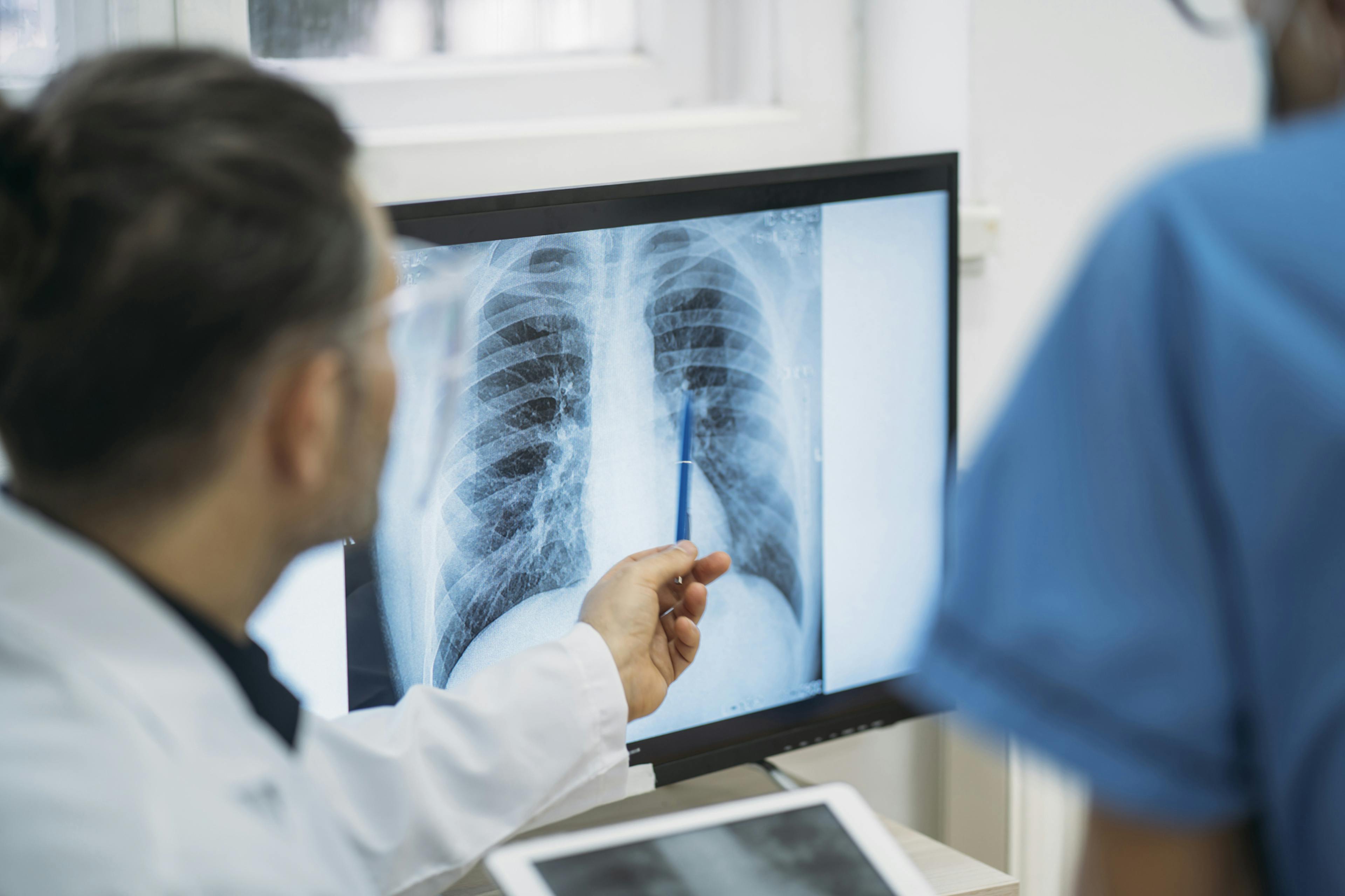A patient's care team reviews a radiology image