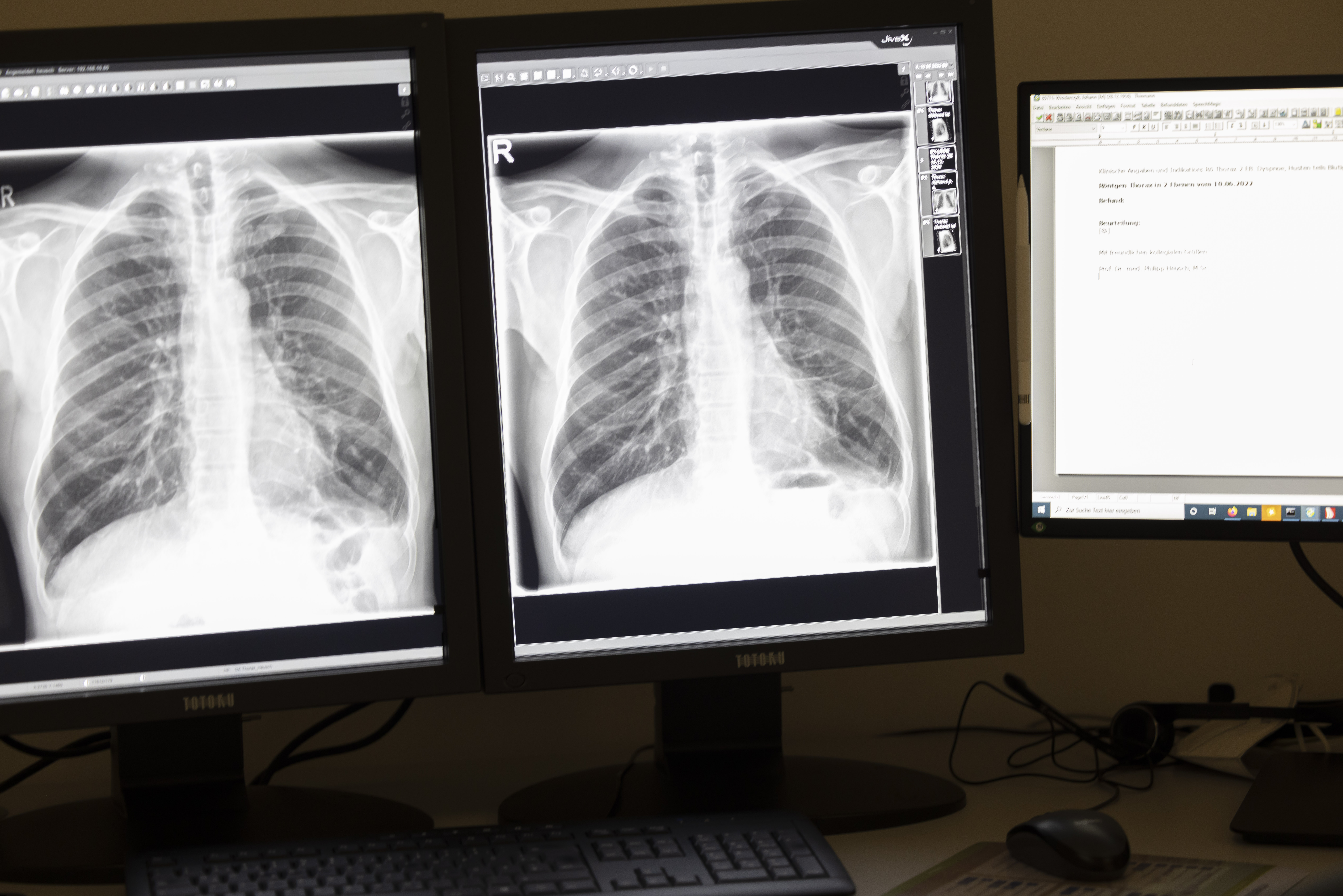 Röntgenaufnahmen auf drei Monitoren