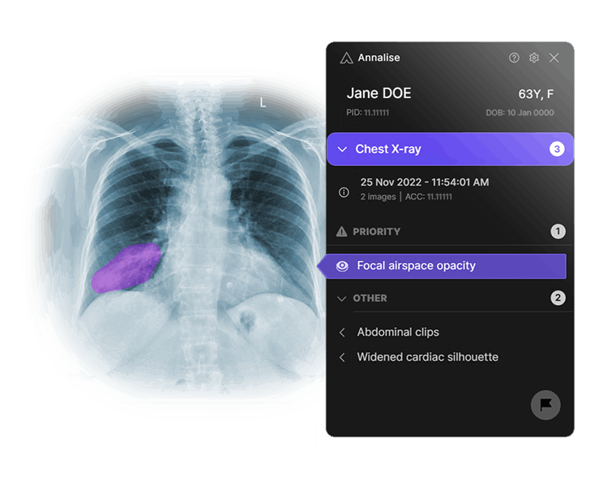 Rayscape | Radiology AI