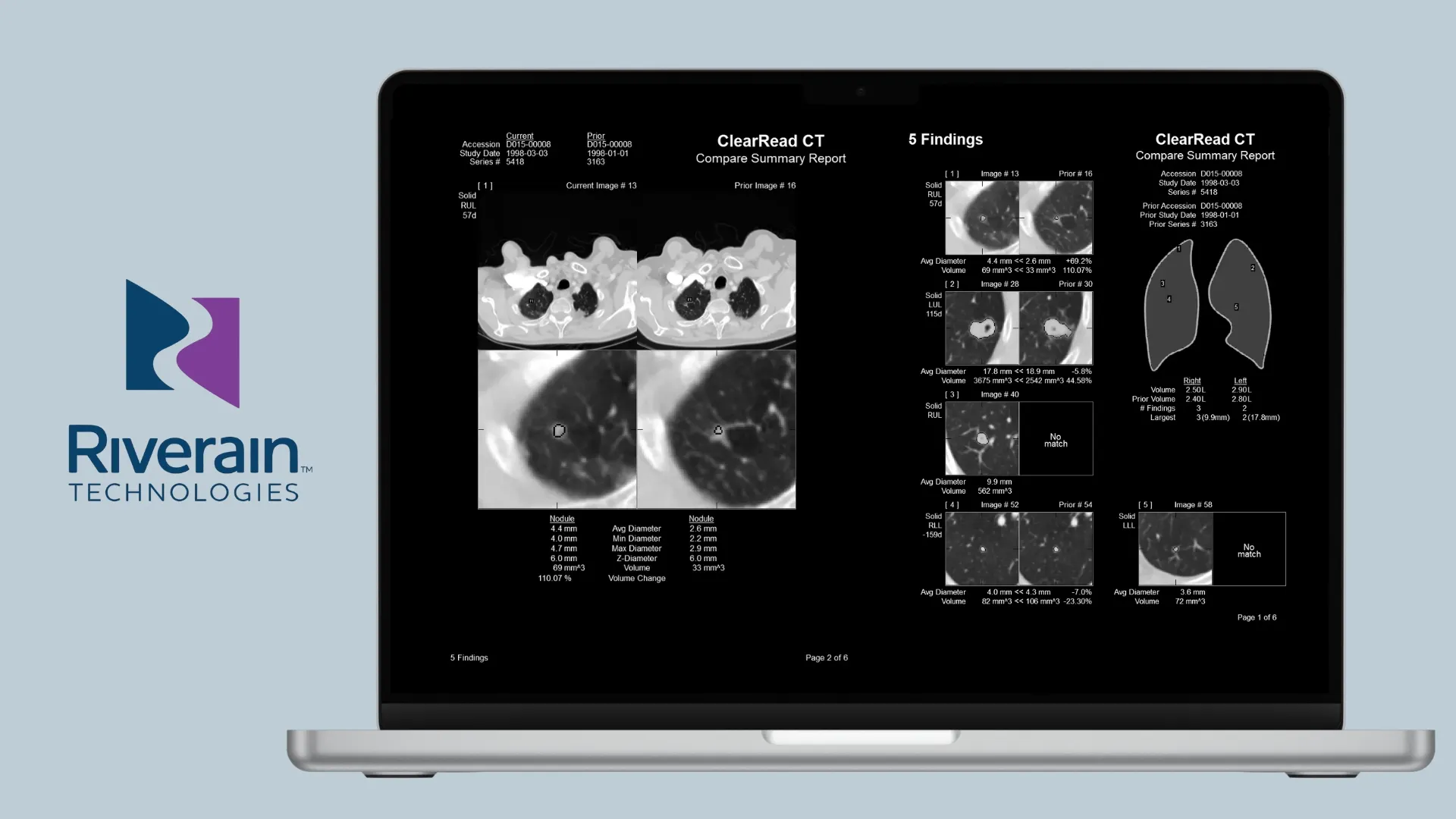 Ct Plus Software Rayscape | Radiology AI