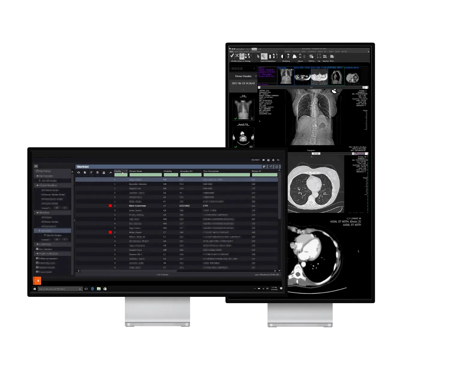 Best AI-Powered Radiology Software In 2024: Part 2